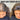 Hair Transplantation - Yay or Nay?