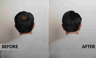 Hair Toppers for Men: A Solution to Hair Loss