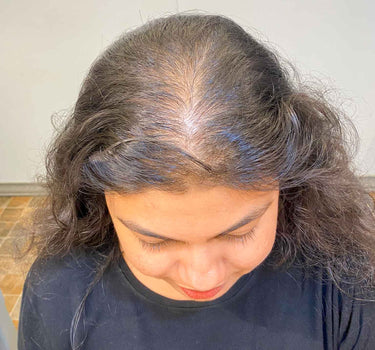 Volume Boosting Hair Topper | 2x2 Lace Topper