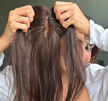 Low Light Scalp Line