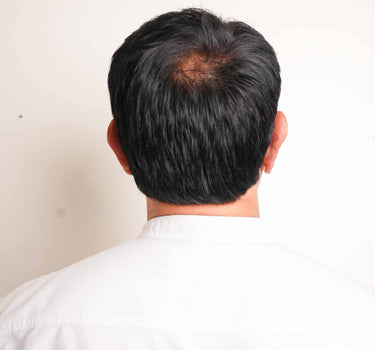 Men Hair Toupée | Pre Cut - Silk Base Most Natural Looking